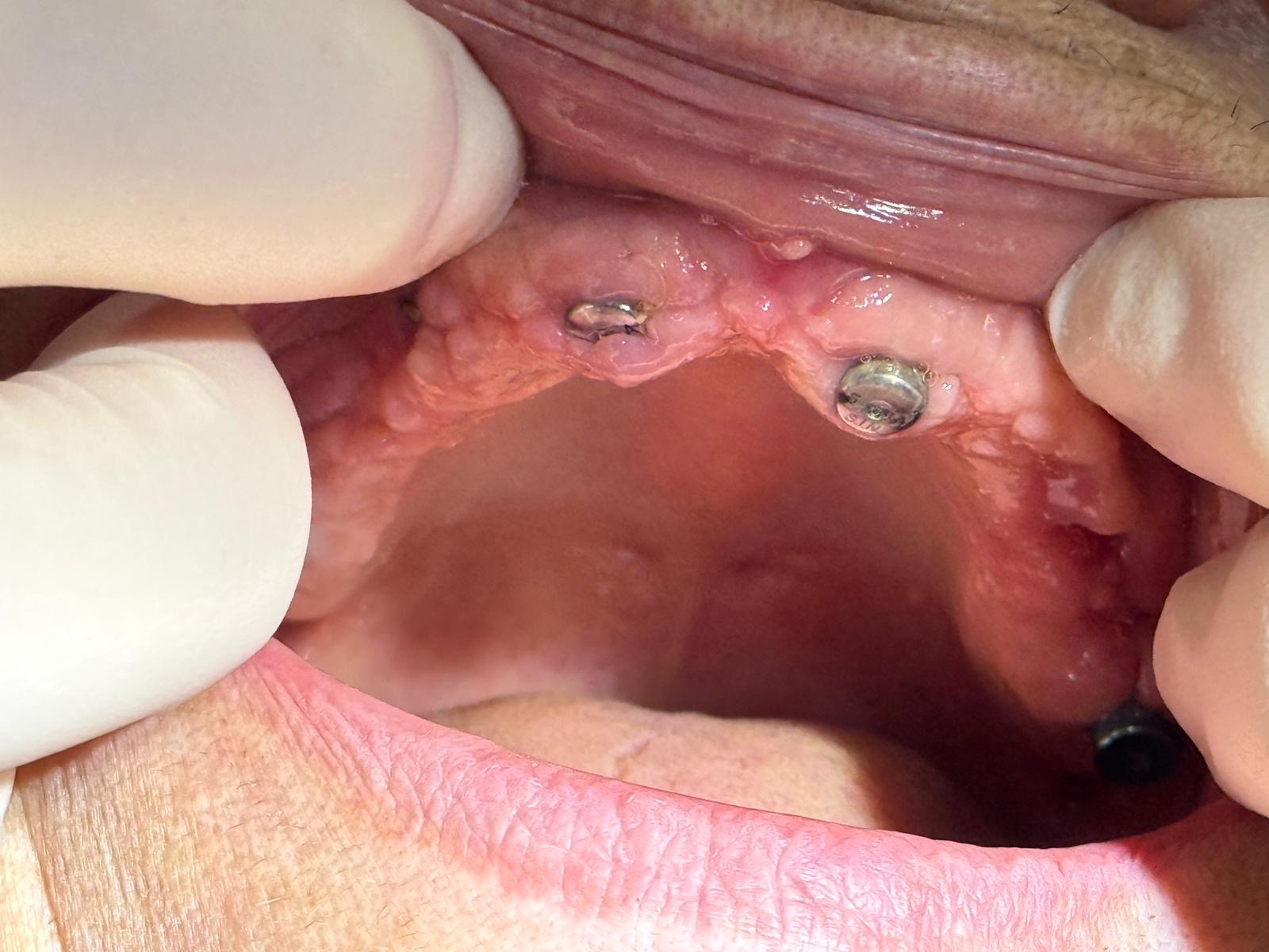 Lucrare dentară