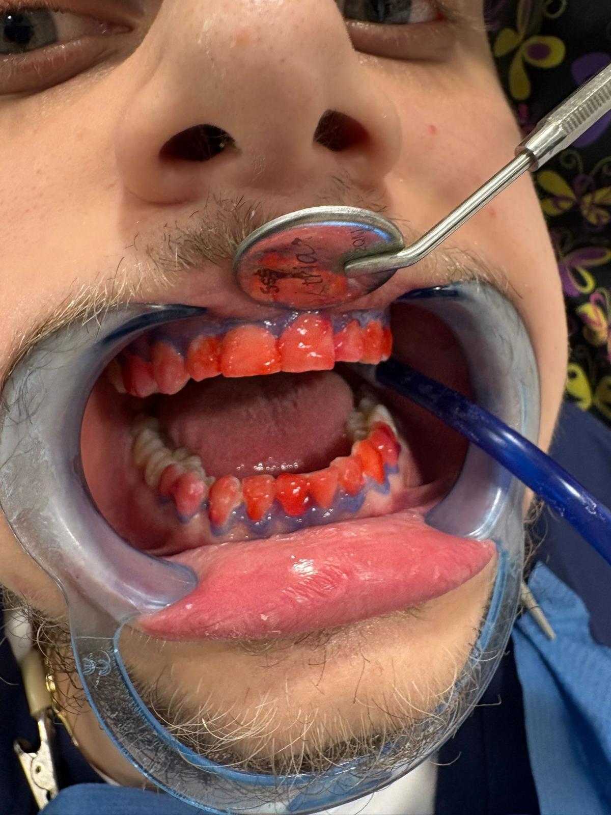 Lucrare estetică
