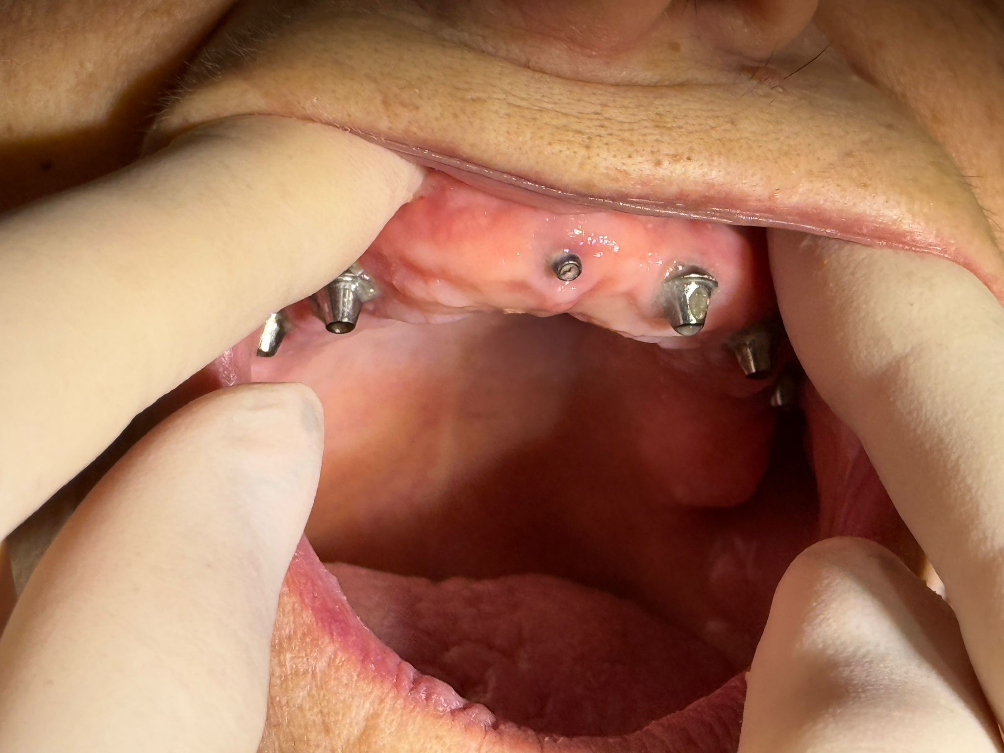 Procedură dentară