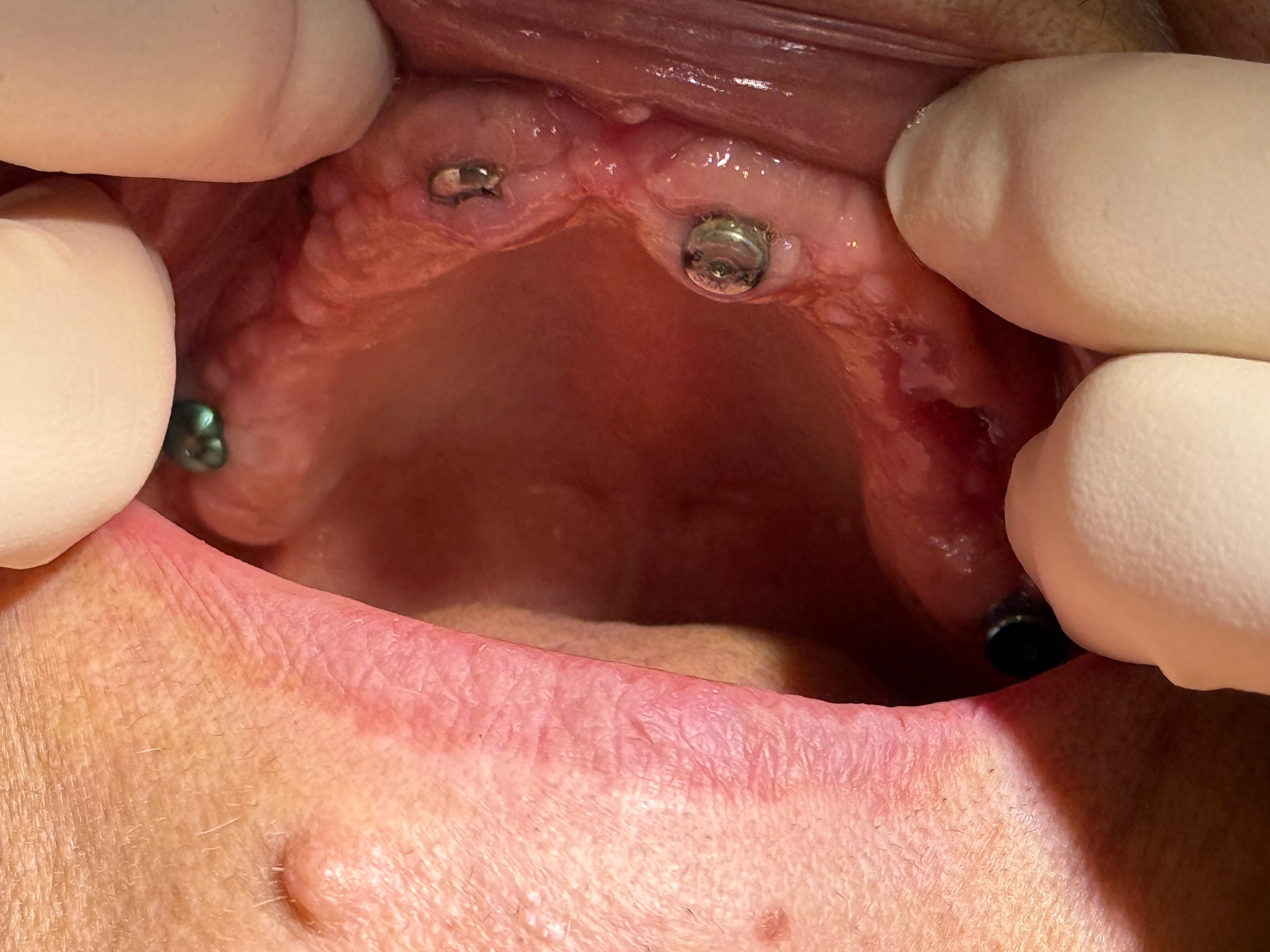 Lucrare dentară