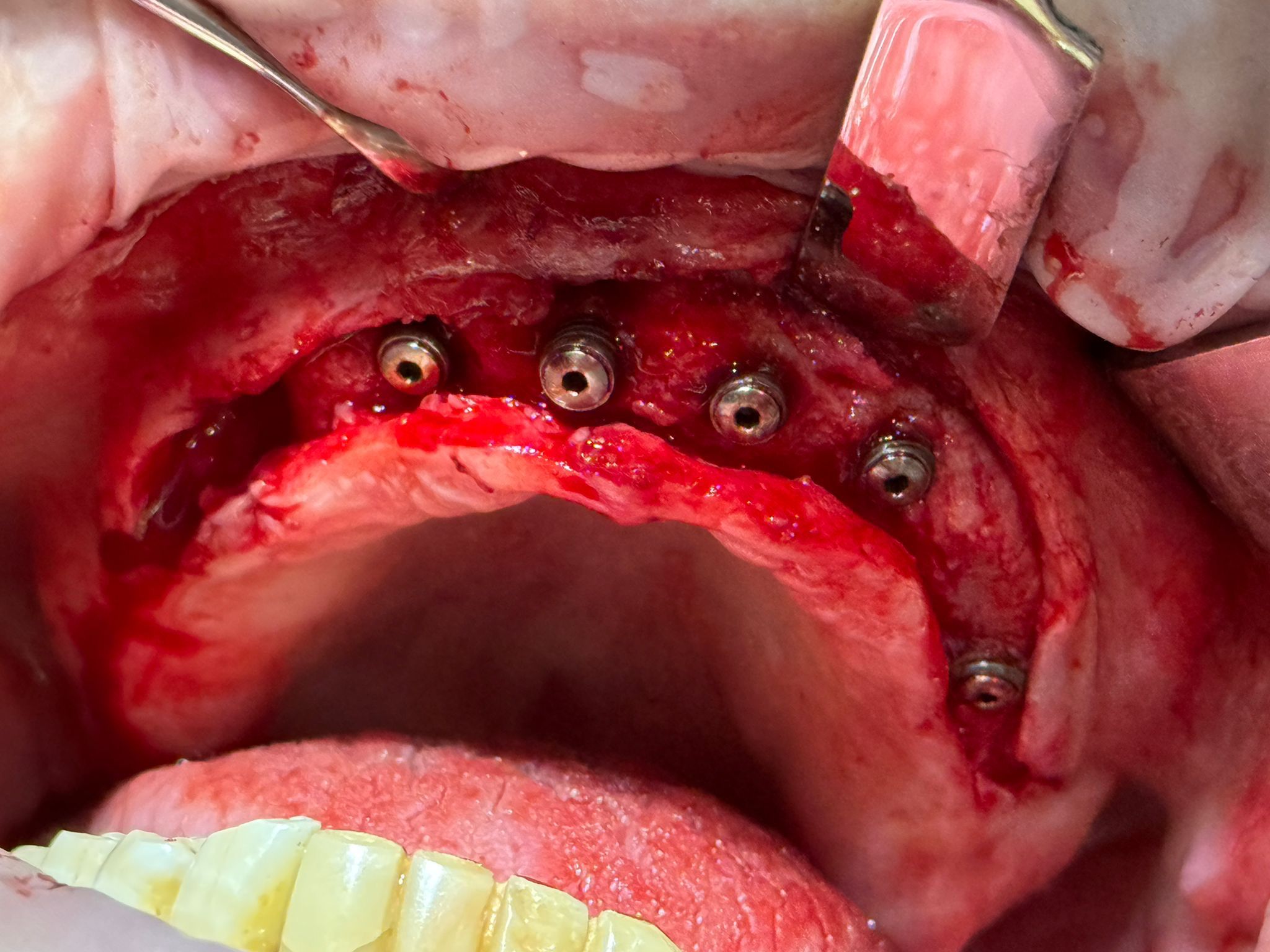 Procedură dentară